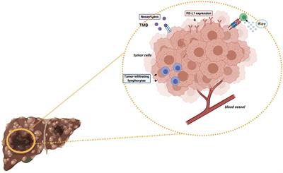 Predictive Biomarkers for Checkpoint Inhibitor-Based Immunotherapy in Hepatocellular Carcinoma: Where Do We Stand?